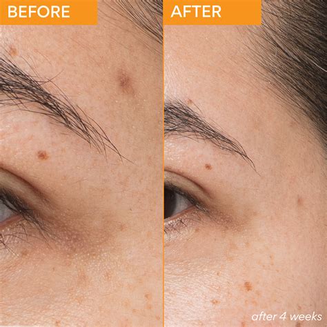 Green Tea Enzyme Vitamin C Brightening Serum 30ml – INNISFREE Australia