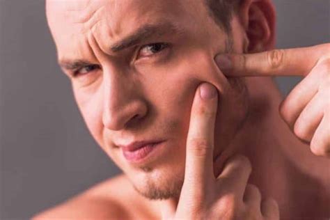how to remove facial ingrown hair