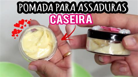 Como Curar Assaduras Em Carne Viva Caseiro - MELHOR POMADA PARA ASSADURAS CASEIRA | POR PAULINHA COPPOLA - YouTube
