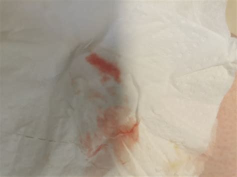 Bleeding At 4 Weeks Pregnant Bleeding 5 Weeks Pregnant