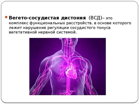 Вегето-сосудистая дистония