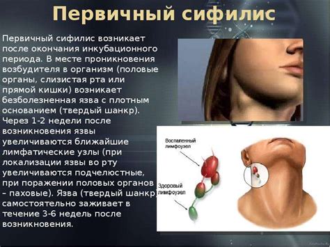 Сифилис. Симптомы сифилиса. Лечение сифилиса Презентация на тему ...