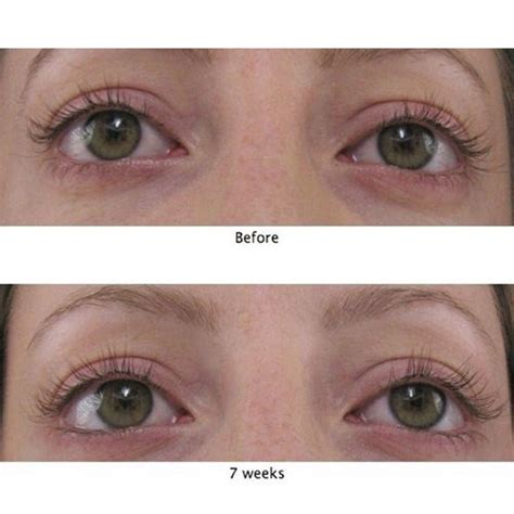 MD® Lash Factor Best Serum for Eyelashes | MD®