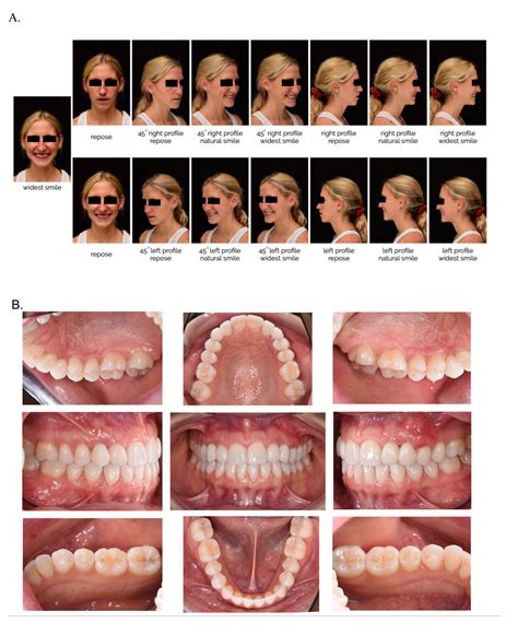 Extraoral Photographs Dental at Ben Birtwistle blog