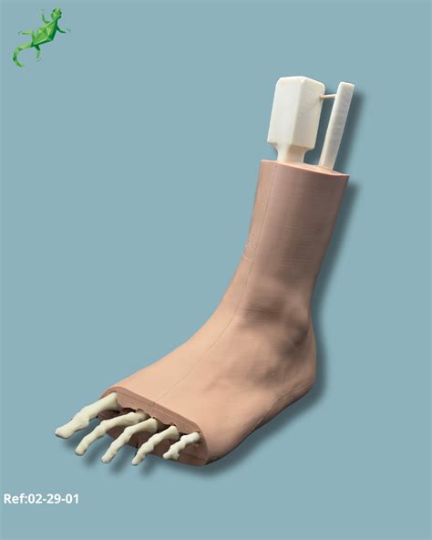 foot ankle  mid tibia fibula  fracture left addi  addi