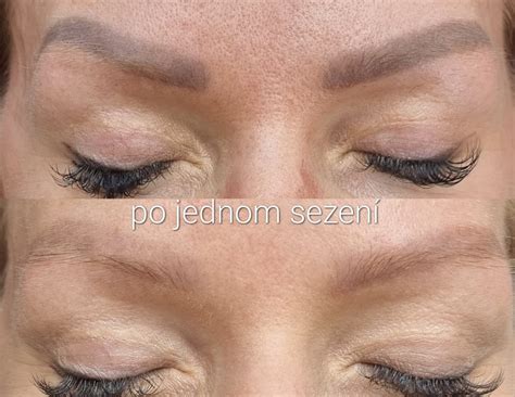Odstranění permanentního makeupu nebo tetování Hradec Králové, Hořice ...