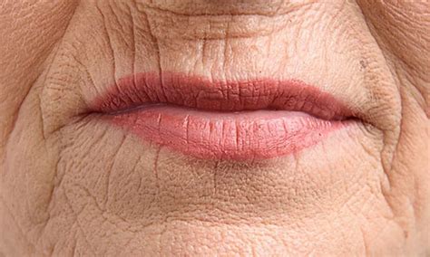 Mental crease (chin wrinkles): causes, prevention & treatments
