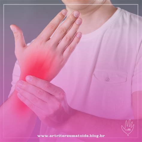 Dormência E Choque Nos Dedos Das Mãos - Dormência ou choque nas mãos? Pode ser síndrome do túnel do carpo ...