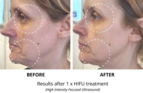 guide   surgical facial visual treatments