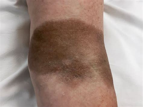 iron infusion stain  robert gump blog