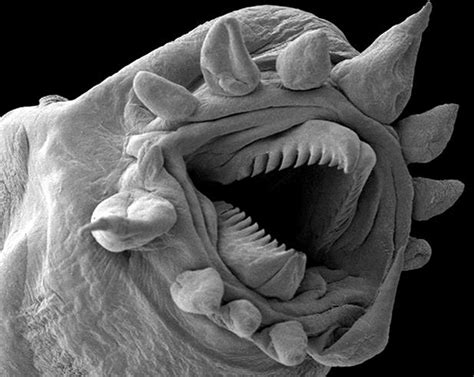 7 Totally Awesome (and Terrifying) Objects Under a Microscope