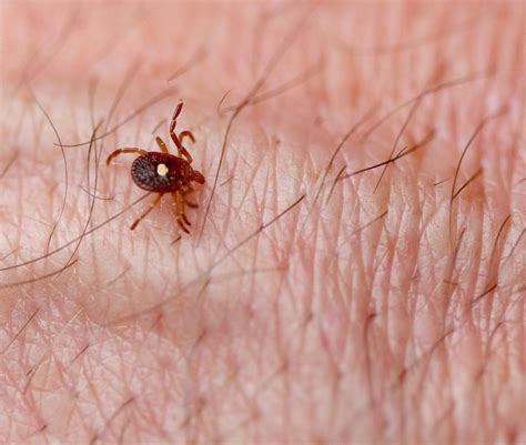 Lone Star Tick Bite: What Happens If You Get Bit?
