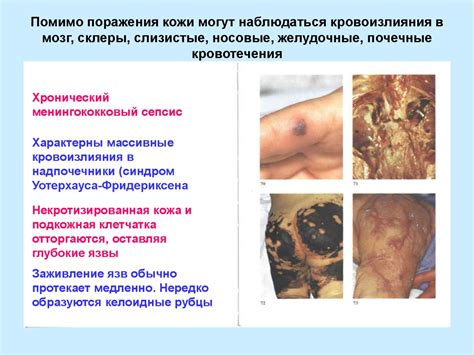 Эпидемиология – наука об эпидемическом процессе - презентация онлайн