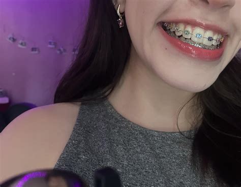 first time I try rainbow, what do you think?💦🌈 : r/Amature_Braces