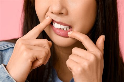 The Signs You Need Perio Laser Treatment | Encinitas, CA