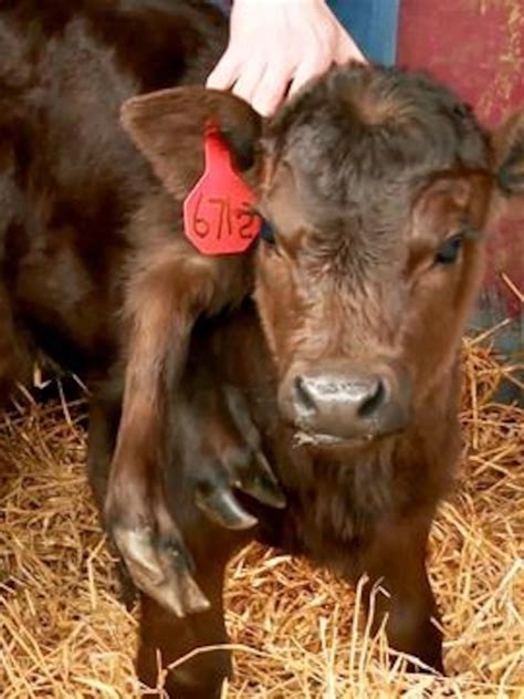 Humans With Extra Limbs