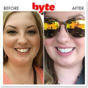 Byte Before & After Photos: Pics of Real Customer Results