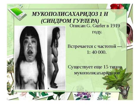 Болезнь Пфаундлера — Гурлер, гаргоилизм - презентация онлайн