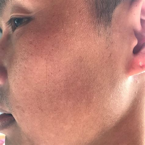 Anona Skin (2025) - All You Need to Know BEFORE You Go (with Reviews)