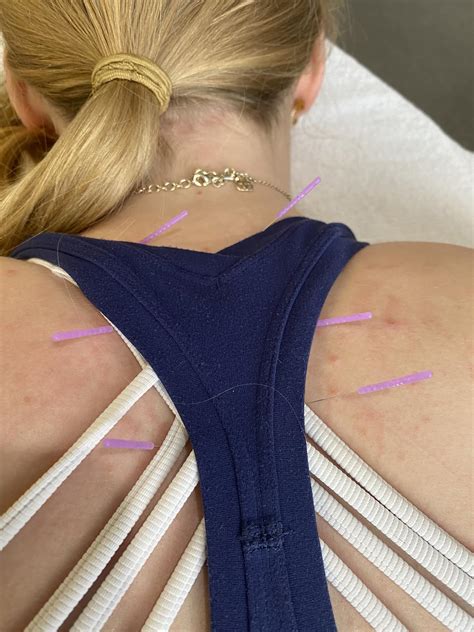 Elevate Physical Therapy | Arlington Heights IL