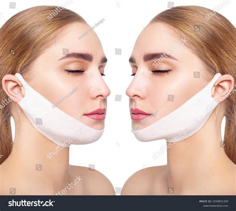 types  chin