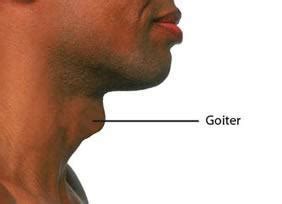 Thyroid Disorders | Board Certified Otolaryngologist & Rhinologist ...
