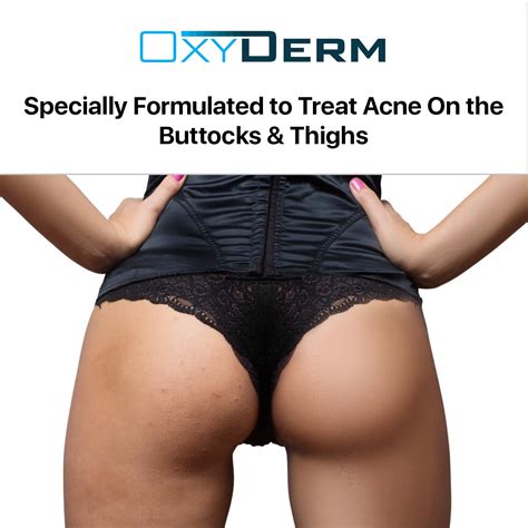 OxyDerm Butt & thigh Acne Treatment Pads - Exfoliating Pads India | Ubuy