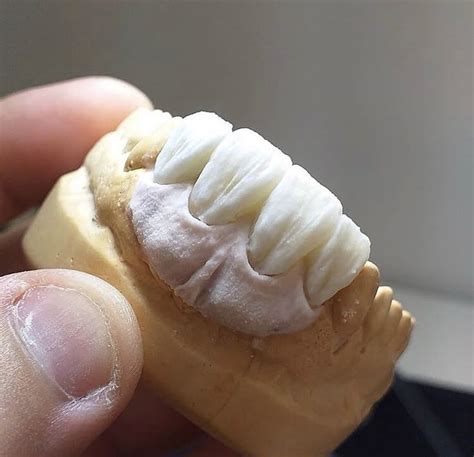 Пин от пользователя EUnice Snchz на доске teeth | Зубной, Зубной техник ...