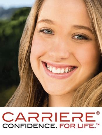 What Is The Carriere Motion Appliance? | Bailey Orthodontics