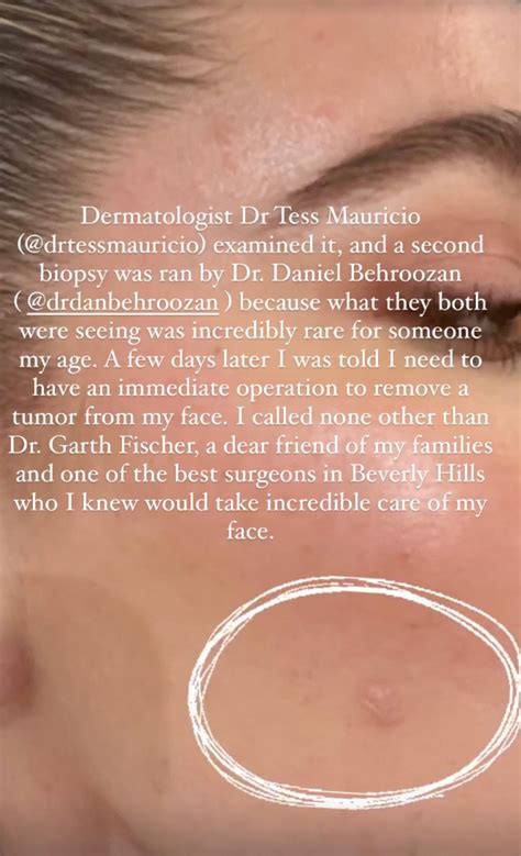 Khloé Kardashian's Health Scare Is a Reminder to Get Your Skin Checked ...