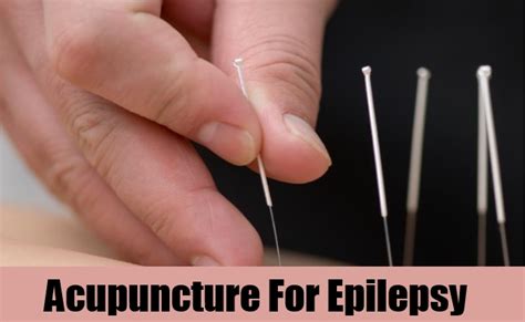 7 Natural Treatments For Epilepsy - How To Treat Epilepsy | Natural ...