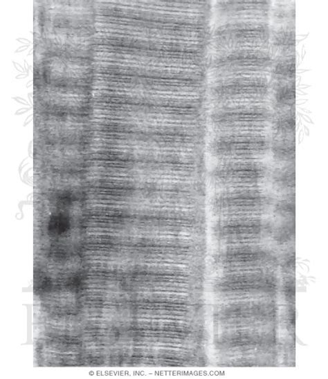 Electron Micrograph of Type I Collagen Fibrils at High Magnification