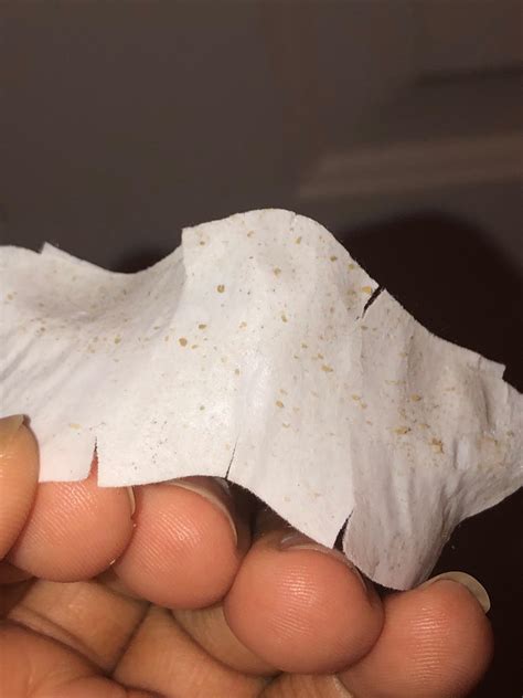 I Tried Unbelievable Blackhead Removal 2024 And This Happened... Image 15