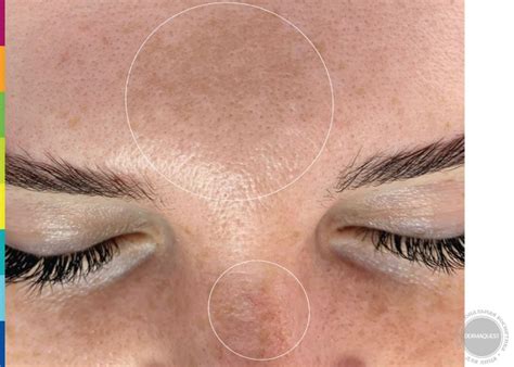 DERMAQUEST » Ретинол от пигментации: как найти идеальное средство ...