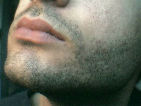 File:Stubbly face.jpg - Wikimedia Commons