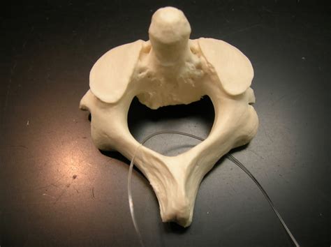 Axis Vertebra Diagram | Quizlet