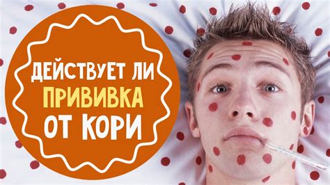 Есть ли у вас иммунитет к кори. Покажет анализ - YouTube