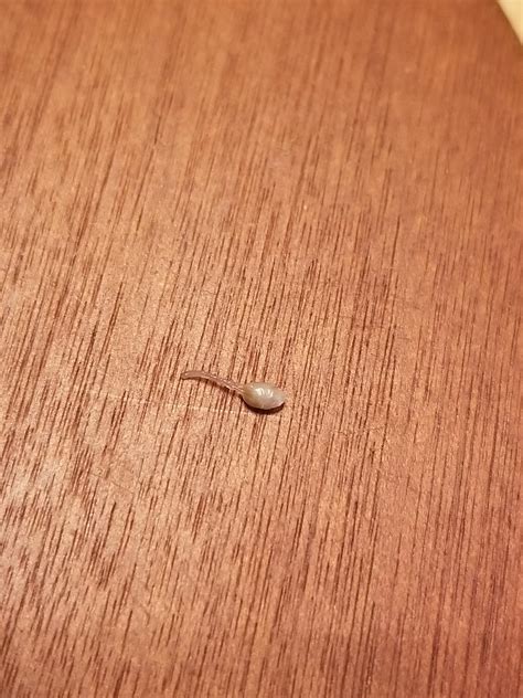 Ladies, I just popped a pimple on my vulva. A legitimate pimple. What