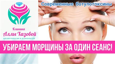 Инъекции ботулотоксина. Контурная пластика в Москве. Ботокс от морщин ...