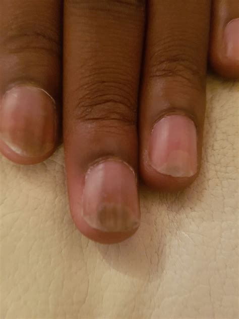 Name That Rash! | Brown Med-Peds