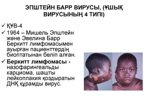 Ұшық вирусы. Табиғи-ошақтық вирусты инфекциялардың қоздырғыштары ...