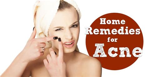 home remedies  natural cures  acne