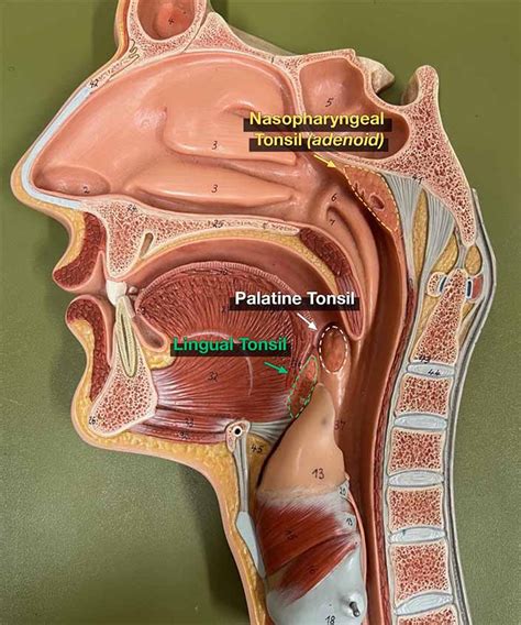 lingual tonsils model