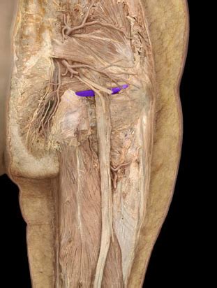 Gluteal Muscles Cadaver Gluteal Region Muscle Labeling Diagram