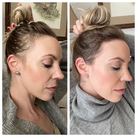 Postpartum Vitamins For Hair Loss - Emporium Barber