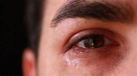 Olho Doendo E Lacrimejando - Olhos que lacrimejam muito, fique atento!