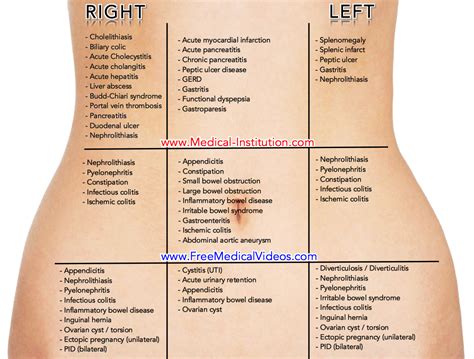 quadrants  abdomen   abdominal pains artofit