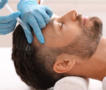 expert  hair treatment  hair loss skinovate aesthetic care