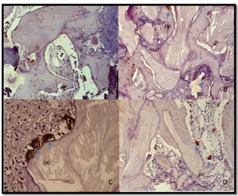 -Immunohistochemical analysis with an antibody to TRAP. A. Group A 25 ...