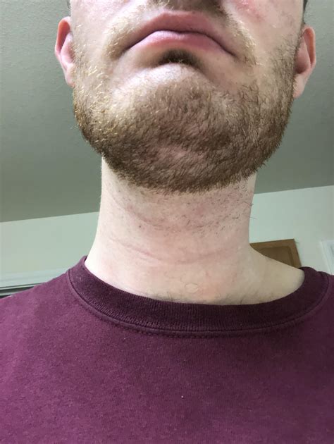 Under Chin Goatee